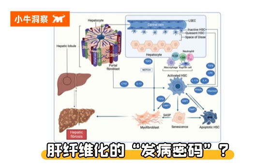 小牛洞察 | 深度解密：肝纤维化的“发病密码”，多细胞 + 多通路的复杂网络