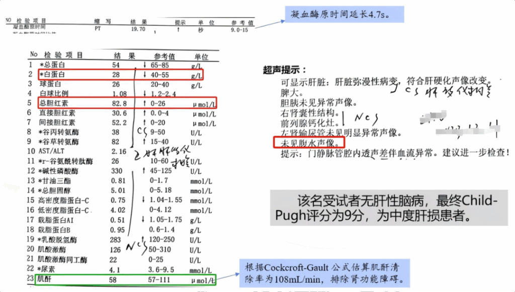 Case：某医院肝损患者Child Pugh分级